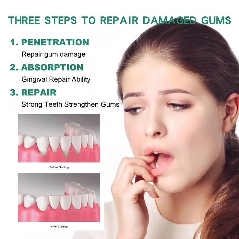 Gum Regrowth Drops - Image 6