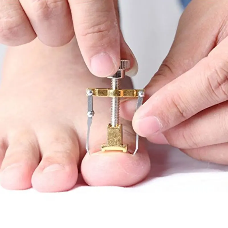 Toenail Screw - Image 8