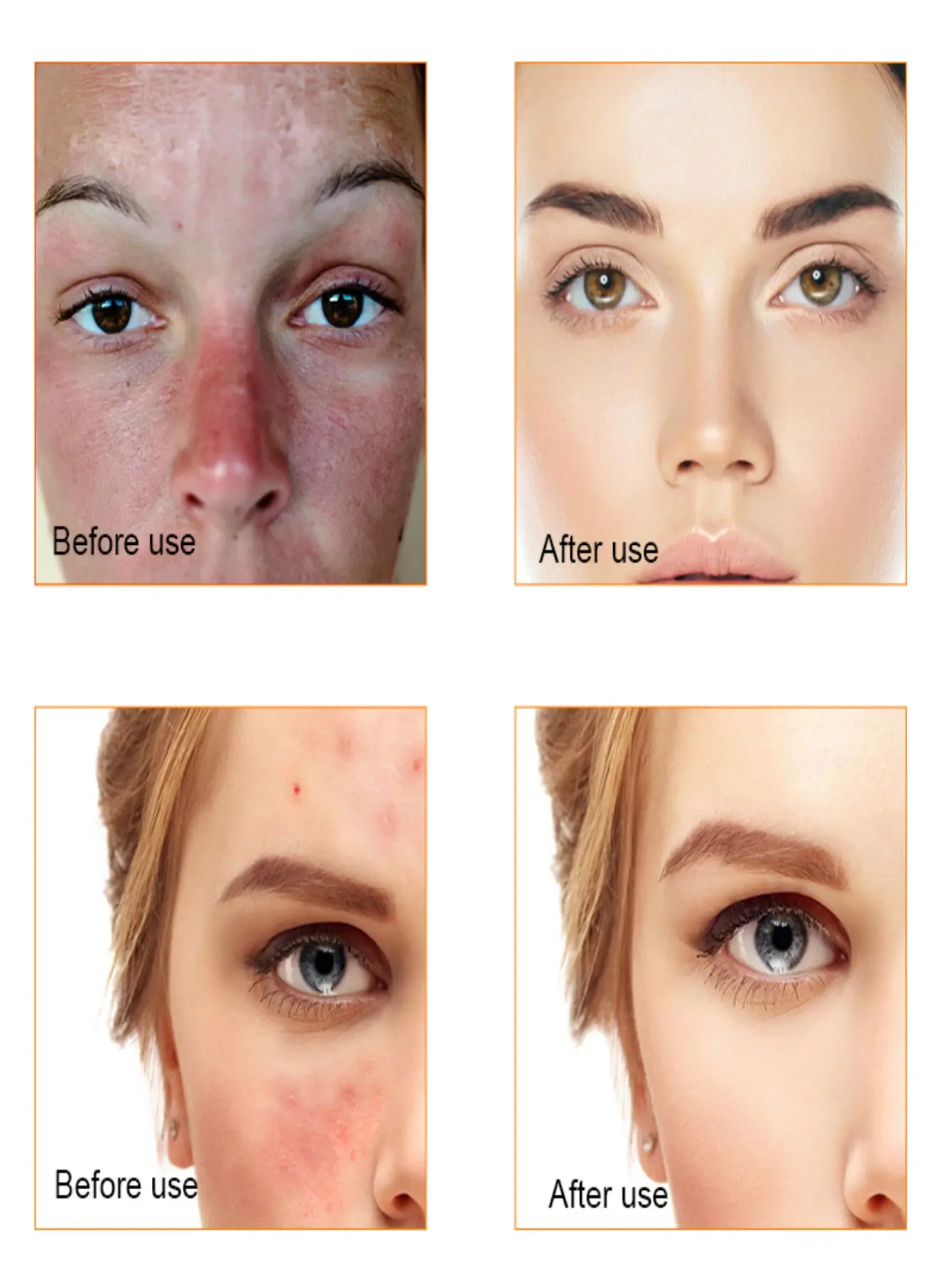 Organic Skin Tag Solution - Image 4