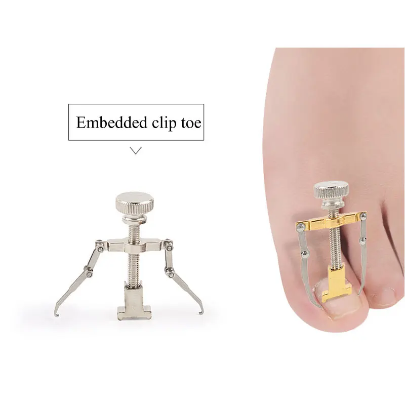 Toenail Screw - Image 6