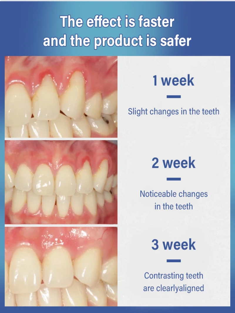 Tooth Regrowth Gel - Image 4